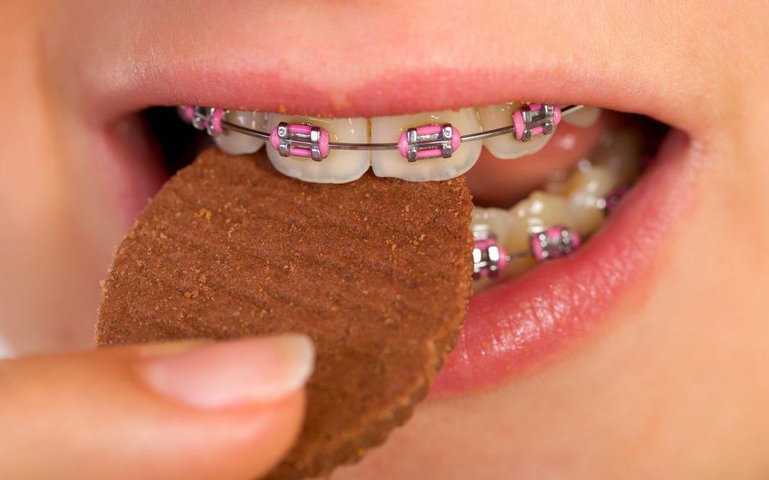 5 alimentos que debes evitar si tienes brackets